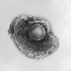 Nanoviricides is targeting viruses such as herpes, above