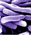 Boehringer will make E.coli amongst other HP clinical materials for Molecular Partners