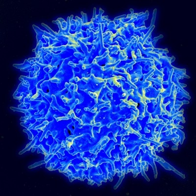 A healthy human T cell.