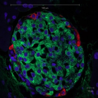 Reliance on mouse beta cells a thing of the past?