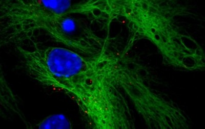 Neural stem cells. Image: Wikimedia/Pdevesap
