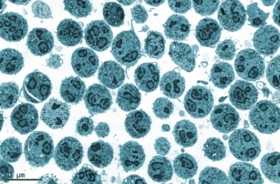 Neutrophils: Stada and Apotex to enter crowded EU filgrastim  market