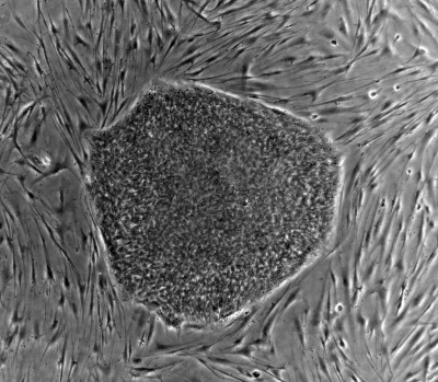 Human embryonic stem cell 