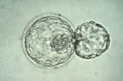 A 6 day-old human blastocyst (Image: K. Hardy/Wellcome Images)