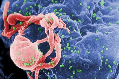 HIV-1 (green) and lymphocyte