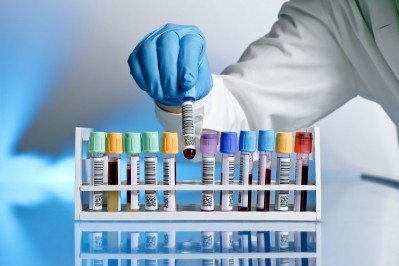 Personalized medicine driving biobanking demand, says sample management provider