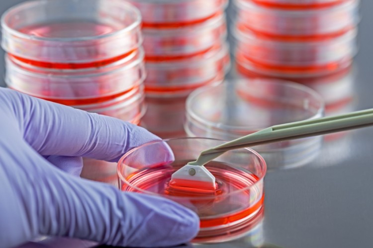 Japan’s PuRec to supply mesenchymal stem cells