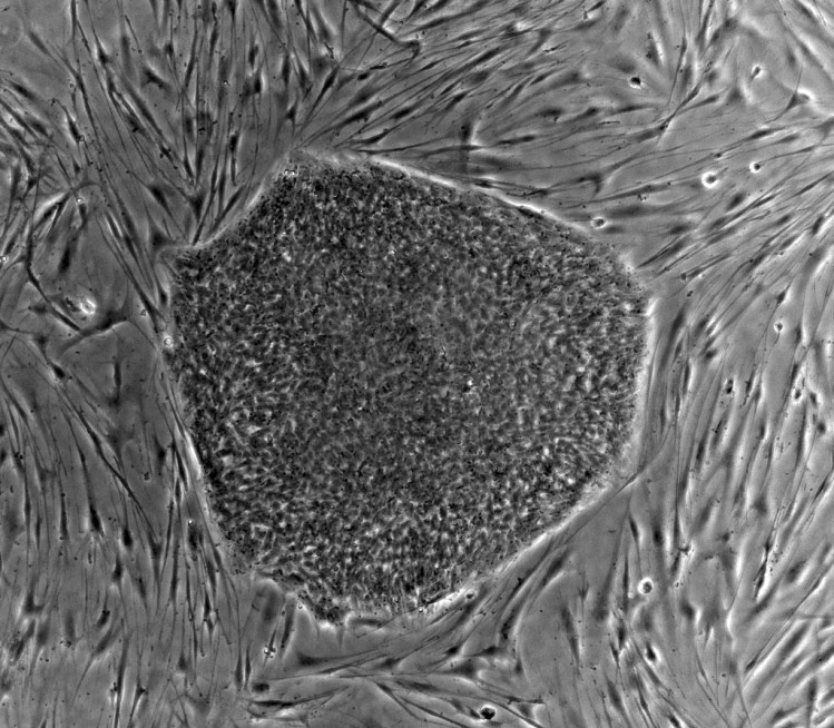 Novartis talks stem-cells but no word on Gamida rumours