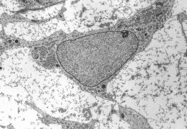 Electron micrograph of a mesenchymal stem cell displaying typical ultrastructural characteristics. Image: Robert M. Hunt