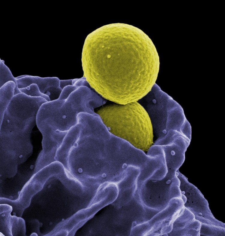 A bacterium (MRSA, yellow) being ingested by an immune cell 