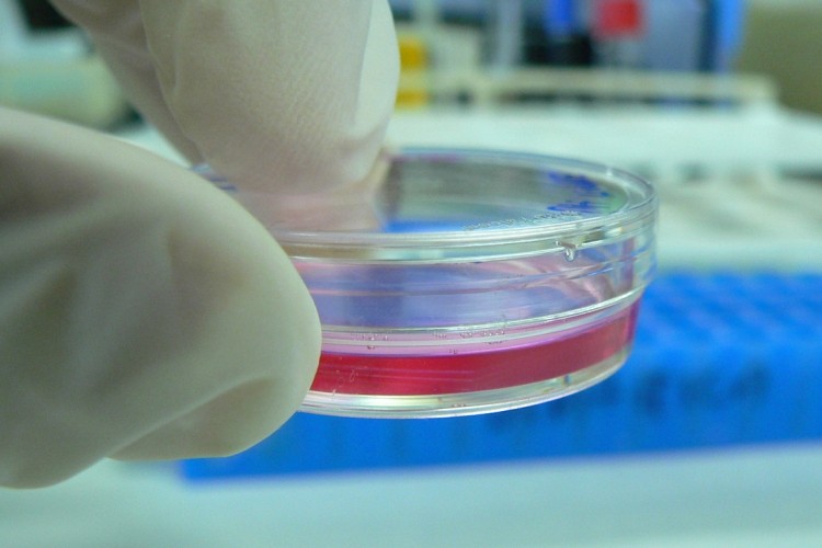 Need for mammalian cell culture is driving bio-outsourcing, accord to market experts
