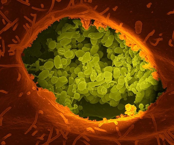 A dry fracture of a Vero cell exposing the contents of a vacuole where Coxiella burnetii (the Bacteria that cause Q Fever) are growing
