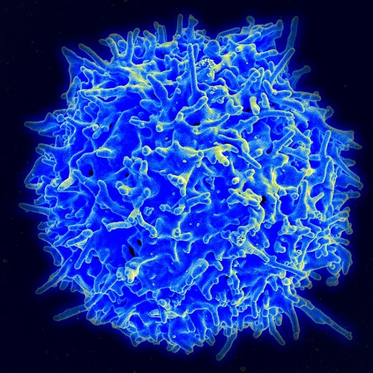 A human T lymphocyte (also called a T cell)