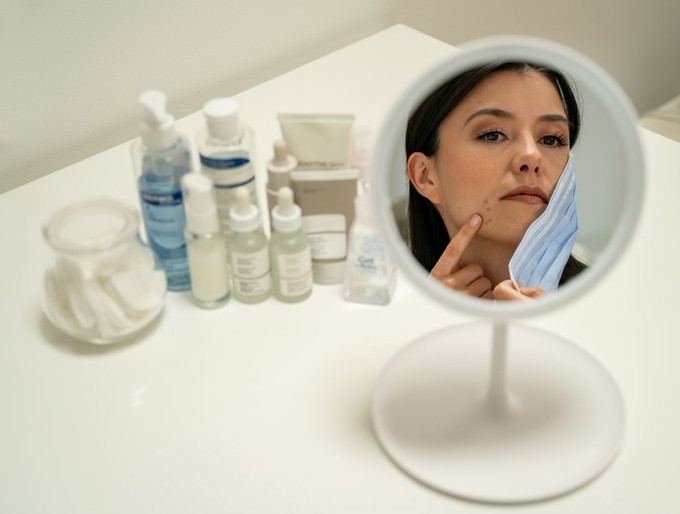 A acne vaccine would treat the root cause rather than symptoms, says Origimm. Pic:getty/hipanolistic