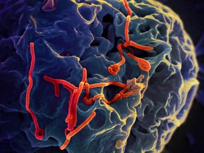 An electron micrograph of the Ebola virus budding from the surface of a Vero cell (African green monkey kidney epithelial cell line). (Image: NIAID)