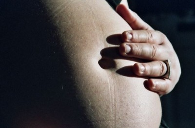 Pregnant women risk passing human cytomegalovirus on to their children