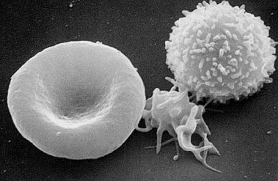 Apotex may join US white blood cell booster market in 2015