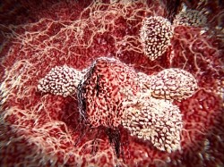 T-lymphocytes attacking cancer cell. Image: GettyImages/selvanegra